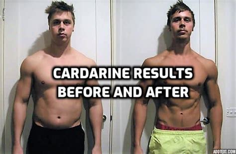 Despite having seemingly positive effects, more than 50 of SARMs users report significant adverse effects. . Ostarine and cardarine stack side effects